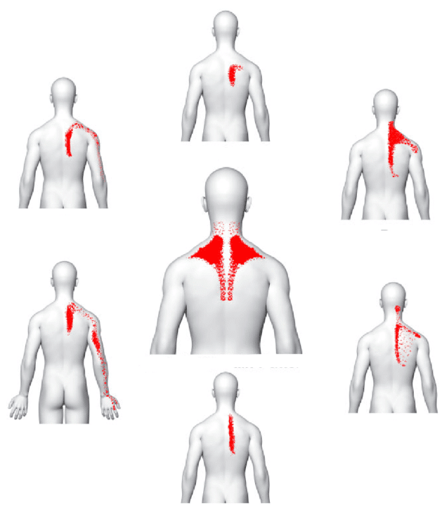 Dental Professionals and Trigger Points